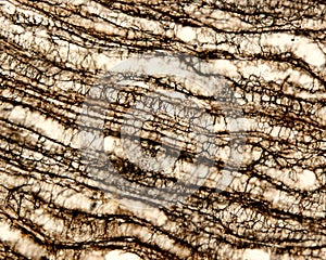 Kidney medulla. Reticular fibers