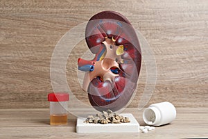 Kidney model with stones, urine sample and pills on wooden table