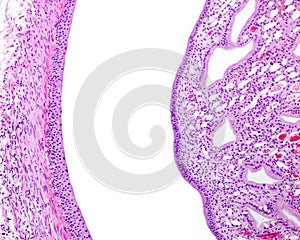 Kidney pelvis and renal papilla