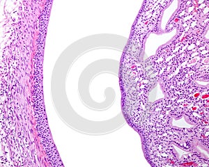 Kidney pelvis and renal papilla photo