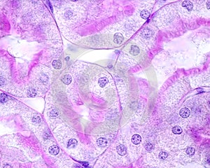 Kidney. Proximal convoluted tubule. Periodic acidâ€“Schiff PAS method