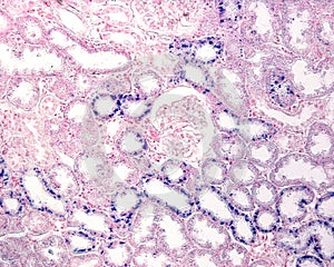 Kidney. Proximal convoluted tubule. Trypan Blue