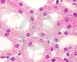 Kidney. Proximal and distal convoluted tubule