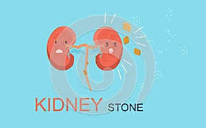 Kidney Stone concept. Nephrology.Pyelonephritis and renal failure disease.