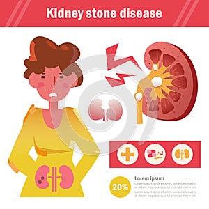 Kidney stone disease Vector. Cartoon.  art on white background. Flat