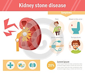 Kidney stone disease Vector. Cartoon.  art on white background. Flat