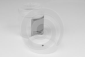 Kidney stone in lid of specimen cup photo