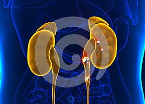 Kidney stones anatomy pain male internal organ painful cristaline mineral cross section - 3d illustration photo