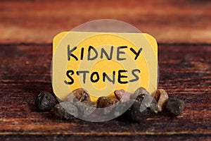 Kidney stones