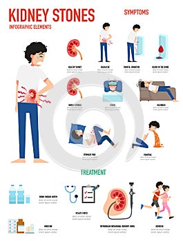 Kidney stones infographic