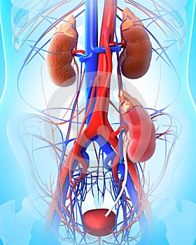 Kidney transplant