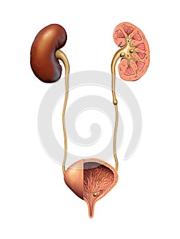 Kidney and urinary stones