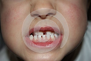 Kids teeths - closeup look