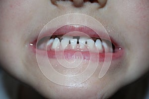 Kids teeths - closeup look