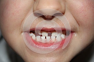 Kids teeths - closeup look