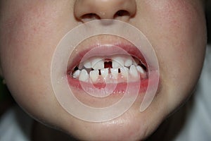 Kids teeths - closeup look