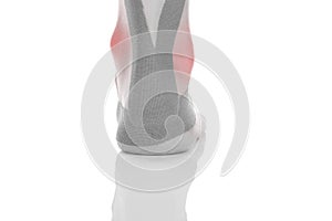 Kinesio tape on female heel