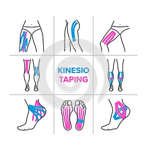 The kinesio taping