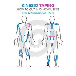 Kinesio taping. How using and how to cut the kinesiology tape