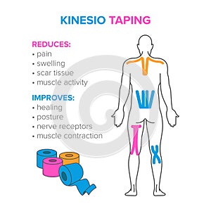 Kinesio taping. Reduses and improves