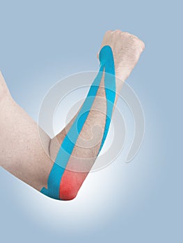 Kinesio tex tape therapeutic treatment of the elbow