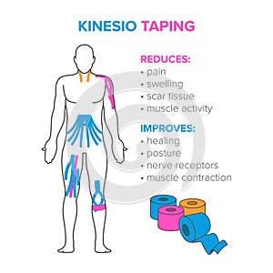 Kinesiology taping. Reduses and improves photo