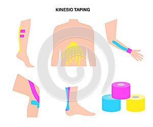 Kinesiology therapeutic tape