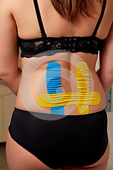 Kinesiology therapeutic taping of lumbar spine of young woman
