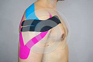 Kinesiotaping, kinesiology tape - application for back pain photo