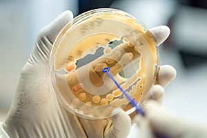 Klebsiella pneumoniae colonies of pink bacteria ferment lactose