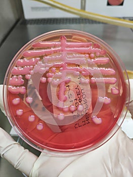 Klebsiella pneumoniae. Urine culture on Macconkey agar photo