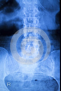 Kneck and spine injury x-ray scan