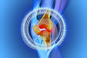 Knee, Anatomy, Bones