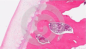 Knee cartilage and bone