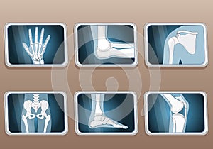 Knee, Elbow, wrist, hip, shoulder joints and Articulations of foot. Set icons