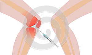 Knee injection inflamation redness vector illustration photo