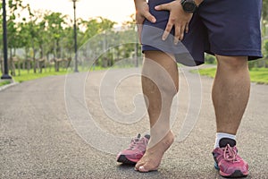 Knee Injuries. Fat man holding knee with his hands in pain after suffering muscle injury during a running workout at park.