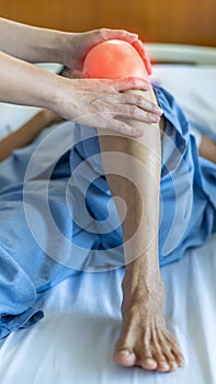 Knee injury and joint pain in elderly patient under doctor surgical medical exam, physiotherapy and treatment from osteoporosis