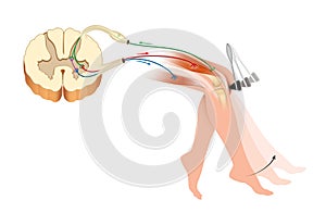 Knee jerk or patellar tendon reflex