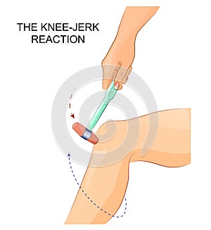 The knee-jerk reflex