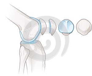 Knee Joint Anatomy. Patella. Illustration photo