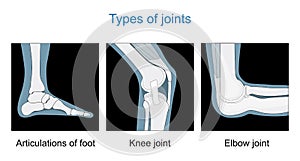 Knee joint, Articulations of foot, Elbow joint