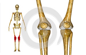 Knee joints