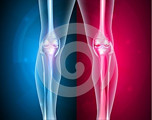 Knee joints healthy and unhealthy photo