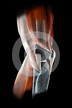 Knee ligaments, tendons, bones, muscles x-ray