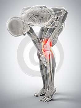 Knee pain