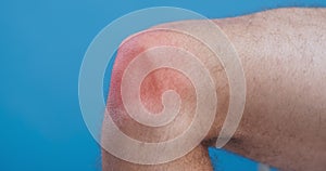 Knee pain, close up of male leg with pulsating red zone