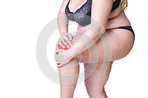 Knee pain, fat woman with joint arthritis, overweight female body isolated on white background