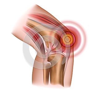 Knee pain. Injury to the leg, patella, knee joint.