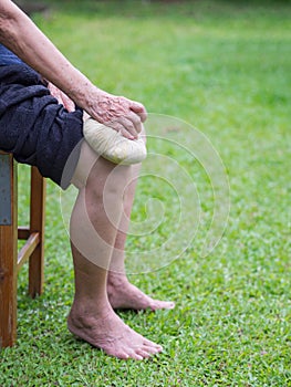 Knee pain in a senior person. Senior woman having knee pain use Thai herbal compress ball on a knee to reduce knee. Knee pain may